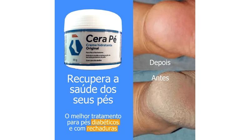 7898083101652-Cera Pé Hidratante para os Pés Restaurador Pés e Rachaduras 50g