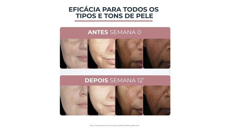 4006000101279-EucerinSerumFacialDualSerumAnti-Pigment30ml-6.jpg