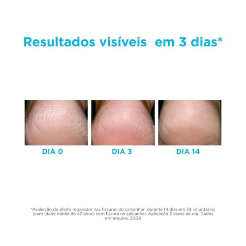 Hidratante Para Os Pés Isdin Ureadin Podos - 80,25G